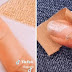 Mulher desenvolve câncer de pele após ter o dedo cortado por manicure