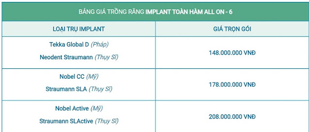 Chi phí trồng răng Implant