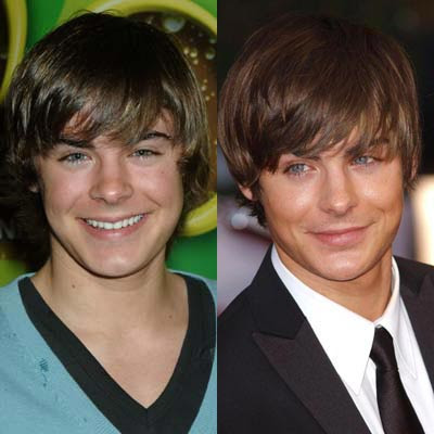 zac efron without makeup. Zac Efron Nose Job ~ Plastic