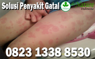 https://obatkhususgatal.blogspot.com/2019/08/obat-gatal-kudis-paling-ampuh-di-apotik.html