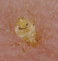 Bed bug bites photos