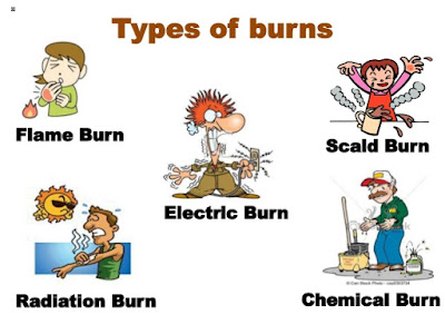 burn treatment, burn, Best burn cream, Physiotherapy, Electrical burn, Chemical burn, flame burn, scald burn