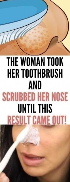 THE WOMAN TOOK HER TOOTHBRUSH AND SCRUBBED HER NOSE UNTIL THIS RESULT CAME OUT!