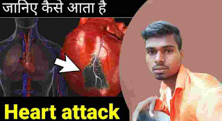 आखिर क्यों आता है हार्ट अटैक - Why does heart attack come after all?