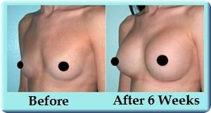 Bigger Breasts Naturally – is it possible?