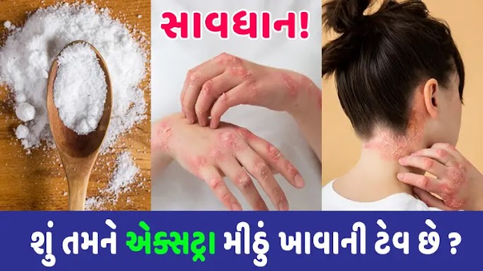 શું તમને વધુ મીઠું ખાવાની ટેવ છે ? થઇ શકે છે આ બીમારી 