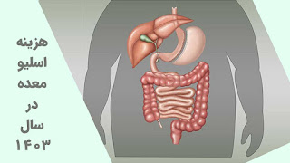 Gastric sleeve cost