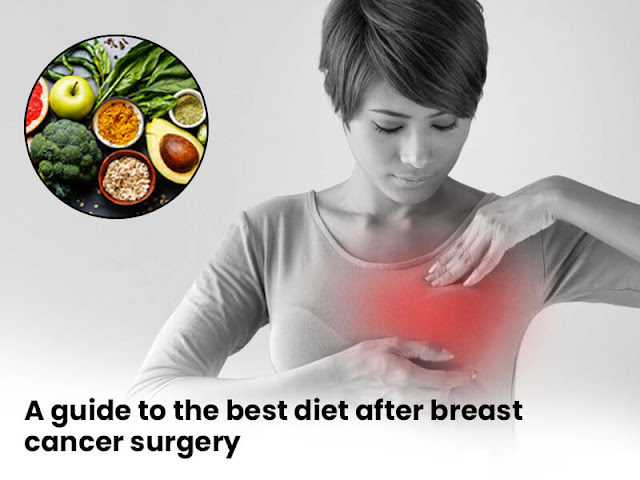 diet chart after breast cancer surgery