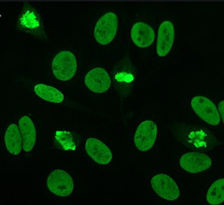 أضداد النوی ANA Anti Nuclear Antibody