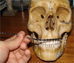 cranionac7