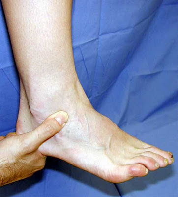 ankle pain