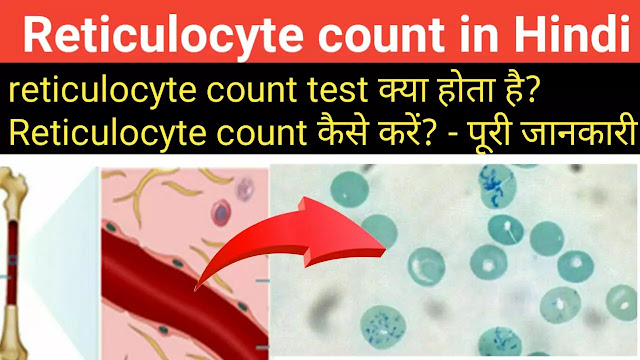 Reticulocyte count in Hindi | Reticulocyte count test कैसे किया जाता है?