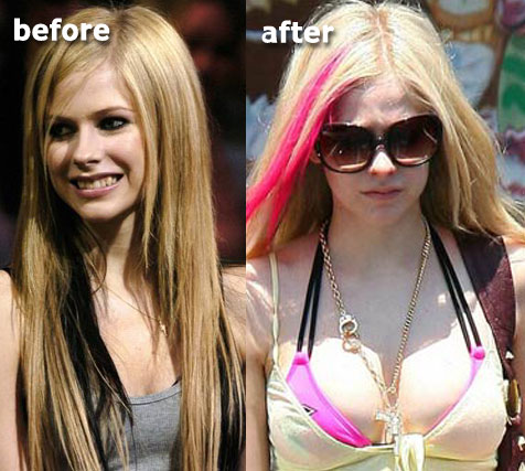 pics of avril lavigne. Avril Lavigne Breast Implants
