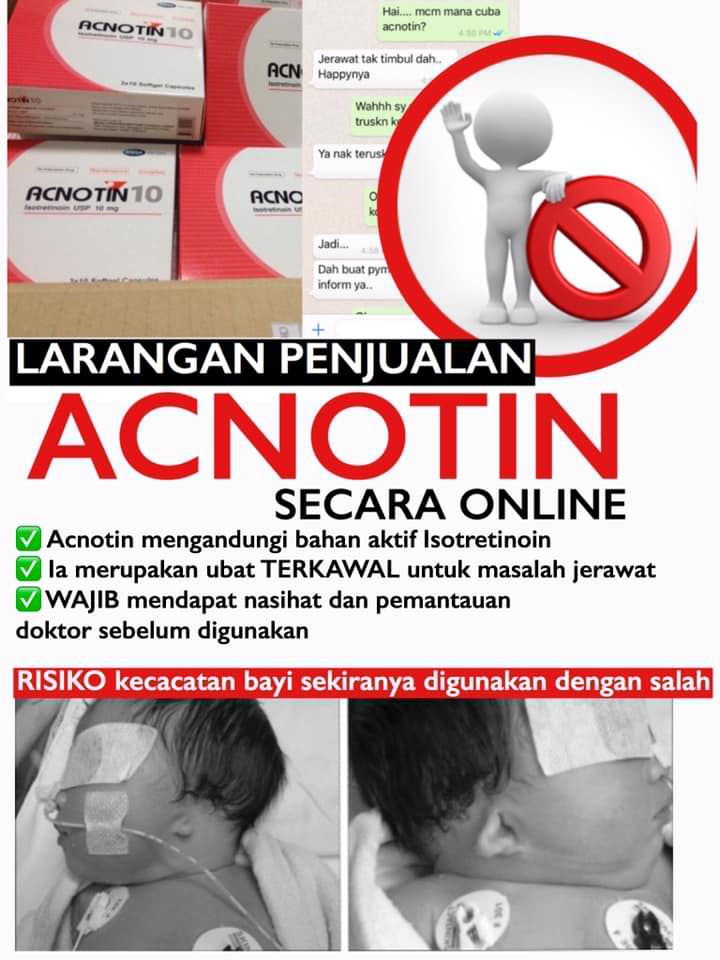 Guna produk kosmetik berbahaya dijual secara online, ibu 