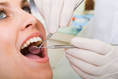 do-you-avoid-san-bruno-dentists-because-of-gagging-1