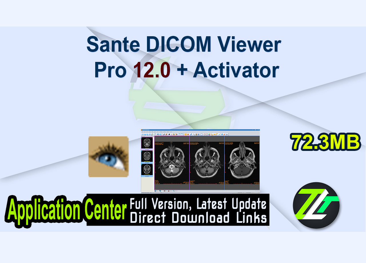 Sante DICOM Viewer Pro 12.0 + Activator
