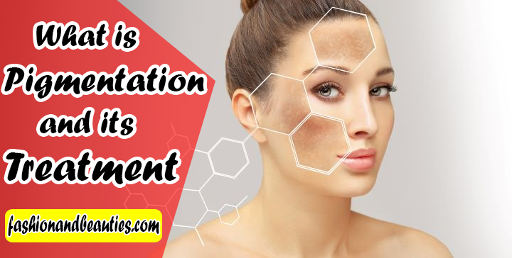 What is Pigmentation and its Treatment?