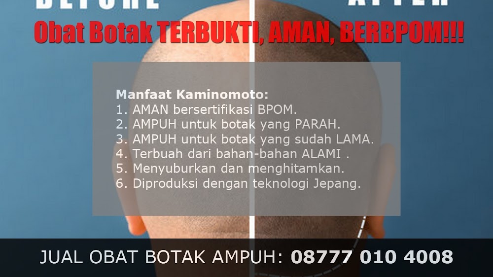 jual OBAT PENUMBUH RAMBUT BOTAK Bobong<br/>