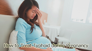 How to Treat Typhoid during Pregnancy