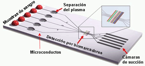 Esquema de un lab-on-a-chip