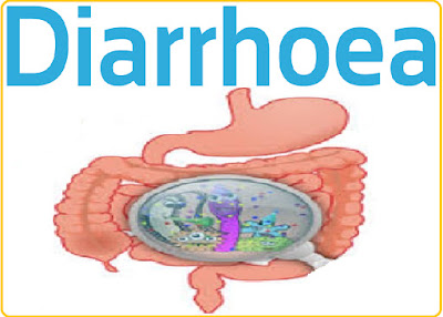 What is diarrhea?