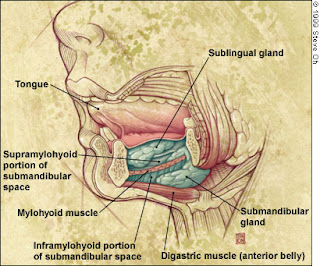 Ludwig's Angina