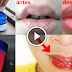 Get Pink Glow Lips By Using This Simple Home Recipe Within Some Days!