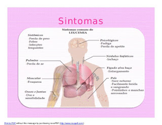 sintomas leucemia infantil, leucemia sintomas e sinais, leucemia sintomas manchas, leucemia sintomas fotos, sintomas leucemia infantil fotos, sintomas leucemia fulminante, sintomas leucemia bebe 7 meses, câncer infantil sintomas, leucemia infantil tratamento