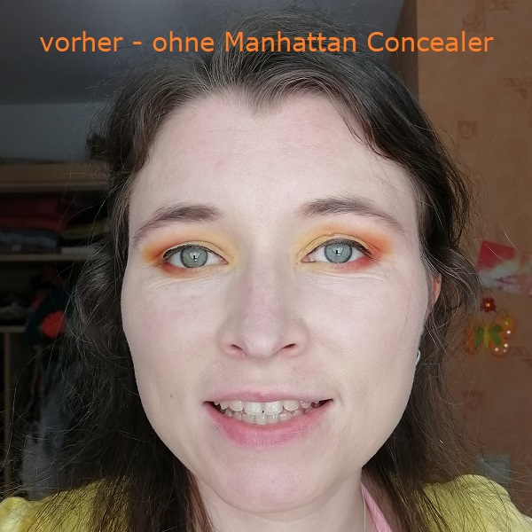 vorher - ohne Concealer