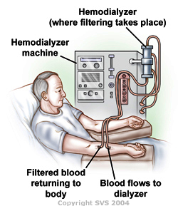 Dialysis Training  Registered Nurses on Hemodialysis Peritoneal Dialysis Capd Apd Or Ccpd Nipd Ocpd