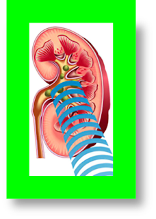 lithotripsy definition lithotripsy procedure lithotripsy medical definition lithotripsy side effects lithotripsy and anticoagulation lithotripsy bleeding after lithotripsy contraindications lithotripsy extracorporeal lithotripsy guidelines lithotripsy indications what happens after a lithotripsy