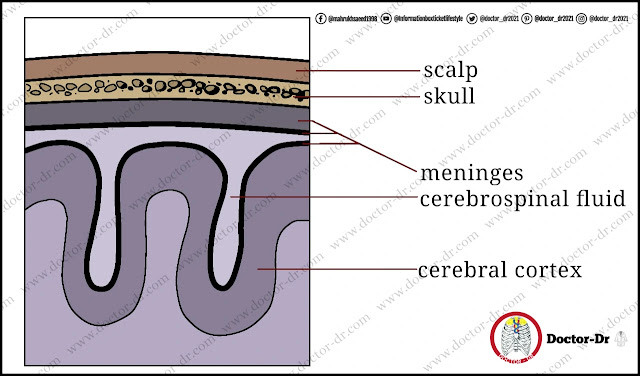 Figure 13-16 The brain's protective membranes, called the meninges, become inflamed in meningitis.