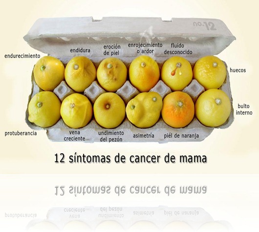 12 sintomas del cancer de mama