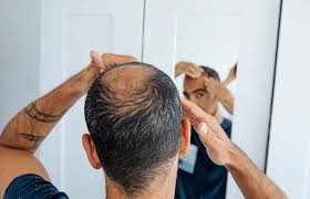 Warning for men: Hair loss drug linked to depression, sexual dysfunction