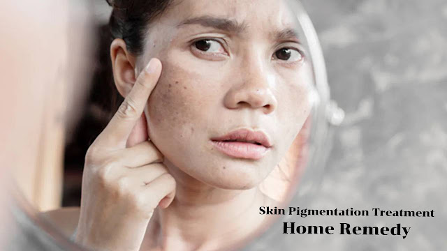 Skin Pigmentation Treatment Home Remedy
