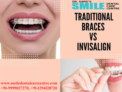 Best Braces Treatment Orthodontist Dental Clinic in Faridabad