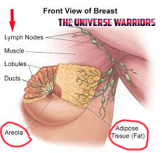 What is Breast cancer?