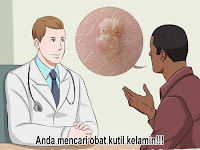 Cara Alami Menghilangkan Kutil Pada Kelamin