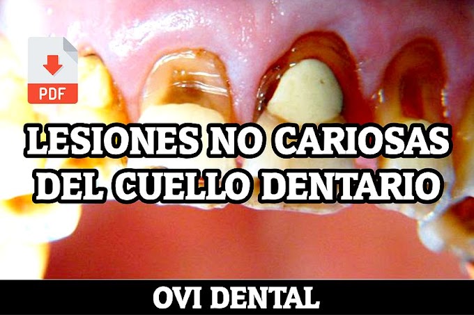 PDF: Lesiones no cariosas del cuello dentario (LCNC)