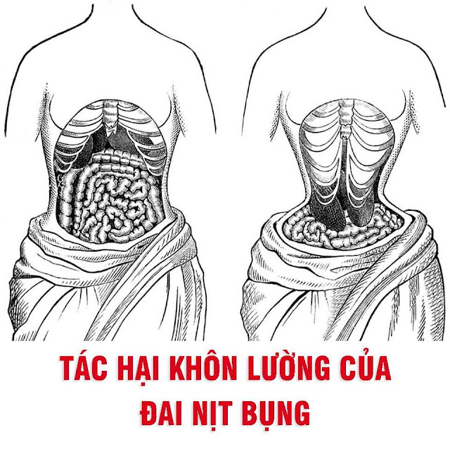 Tác hại khôn lường của đai nịt bụng