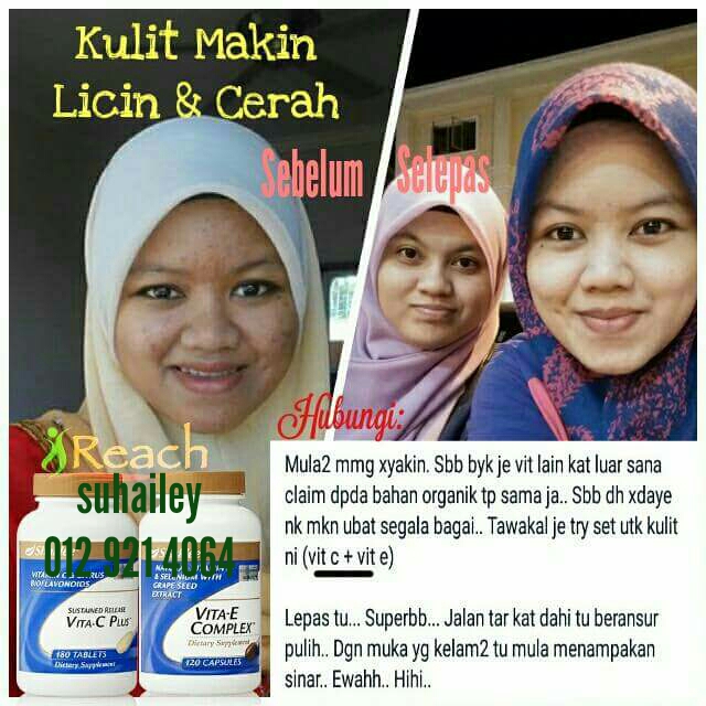 5 Testimoni Vitamin C Shaklee Kulit Kusam Kini Kembali 