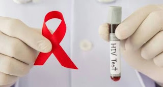 4 Hal Menjalani Hidup Sehat Setelah Didiagnosis Dengan HIV/AIDS