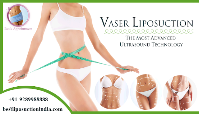 best liposuction in delhi