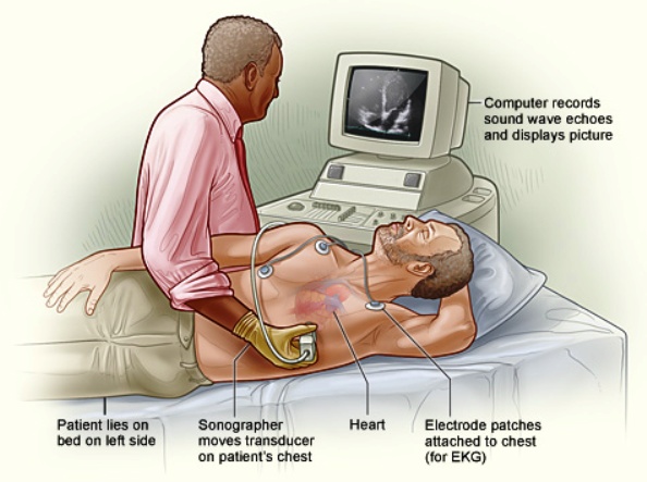 CPT Codes for Echocardiogram and Echocardiography