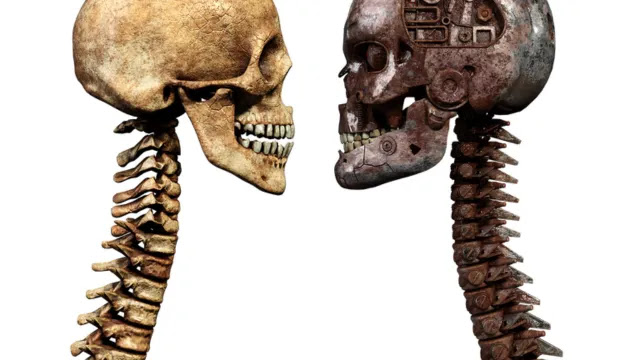 CERVICAL RADICULOPATHY : MEANING AND ITS SYMPTOMS