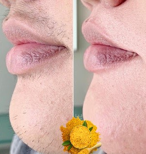 Épilation définitive au curcuma: masque (dépilatoire, anti points noirs, antirides, liftant)