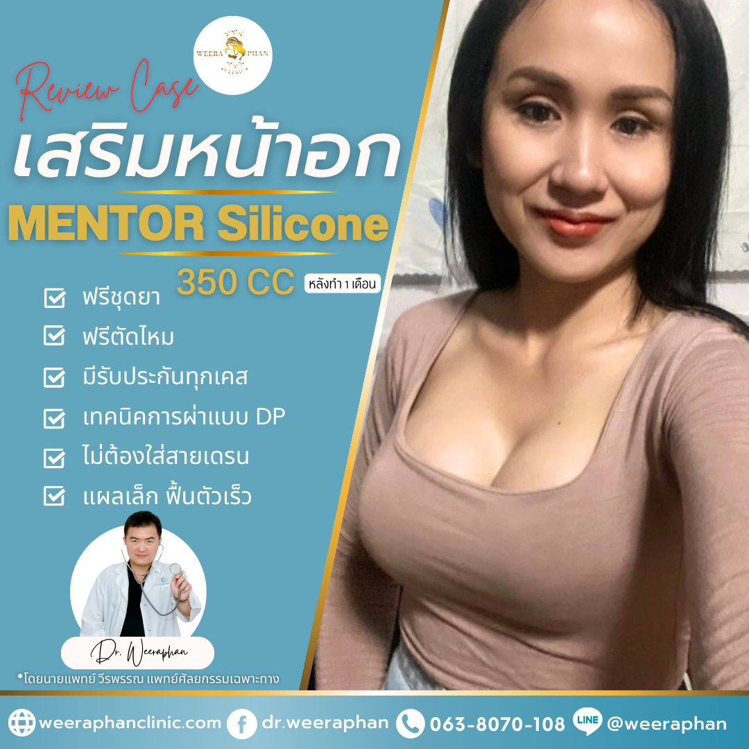 ซิลิโคน mentor รีวิว