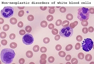 Non-neoplastic disorders of white blood cells