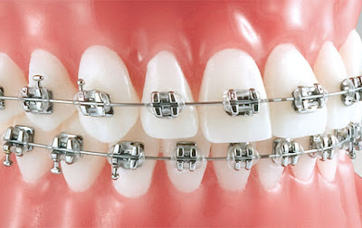 What does orthodontic treatment involve?