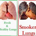 10 Most Dangerous Diseases Caused by Smoking